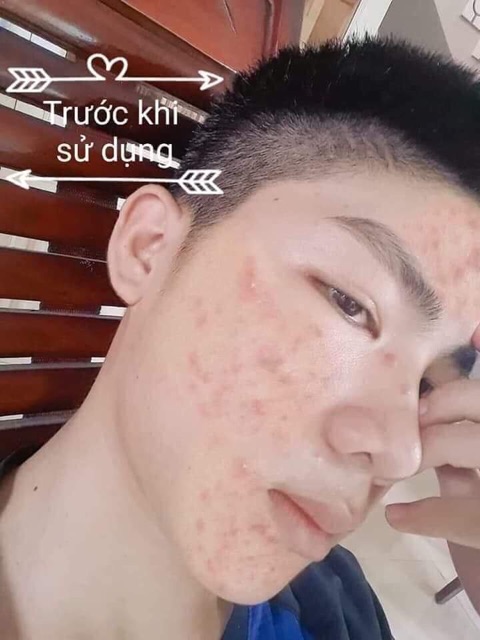 Kem sâm cô tiên Thái Lan - [NOON Fashion]