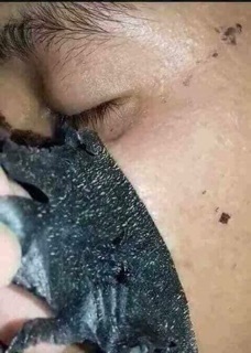 Gel Lột Mụn Black Mask