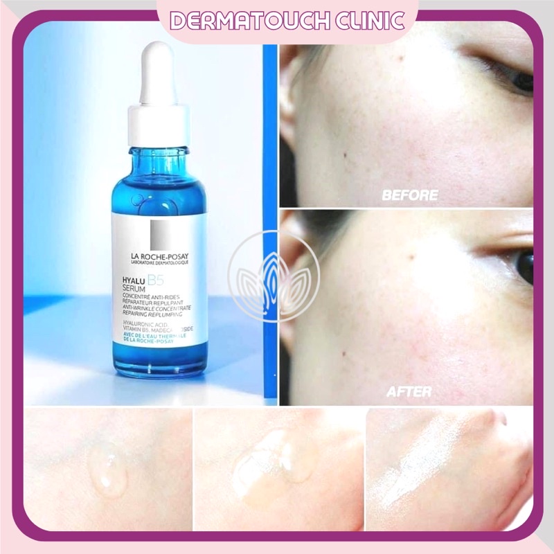 ✅[Chính Hãng] Serum La Roche-Posay Hyalu B5 hỗ trợ quá trình tái tạo da