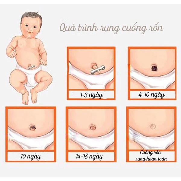 Băng Rốn Đông Fa, Gạc Rốn Cho Trẻ Sơ Sinh (Hộp 3 Miếng