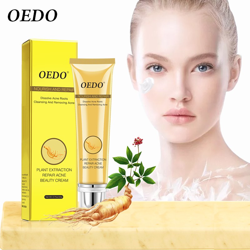 Kem Hỗ Trợ Giảm Mụn OEDO Kiềm Dầu Thu Nhỏ Lỗ Chân Lông Ngăn Ngừa Mụn 20g | BigBuy360 - bigbuy360.vn