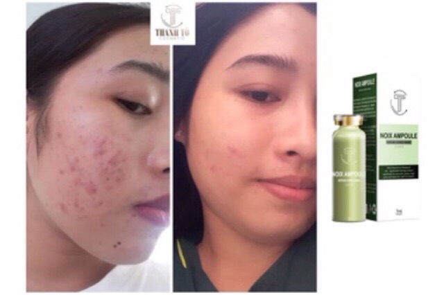 serum JIIUHEE chính hãng | BigBuy360 - bigbuy360.vn