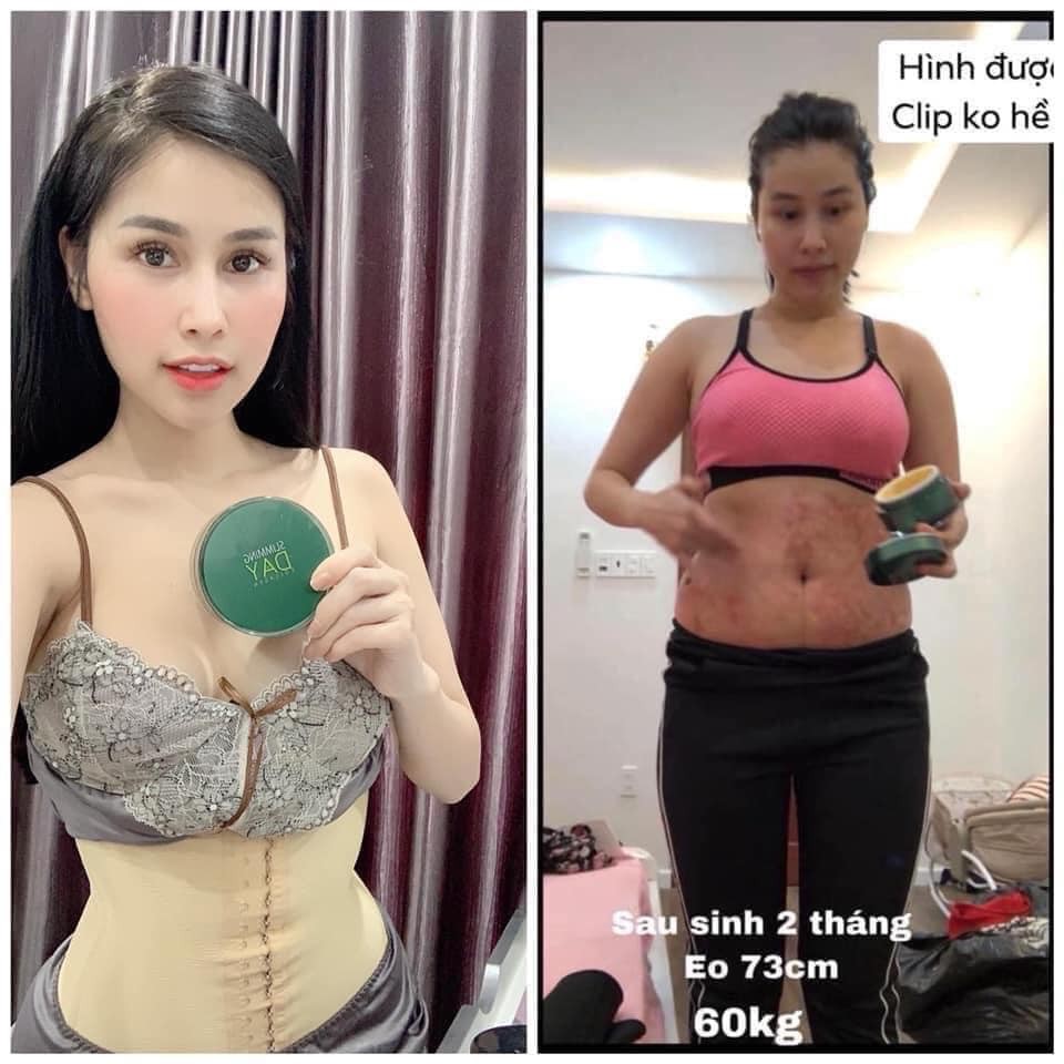 Kem tan mỡ mờ rạn Slimming Day Collagen