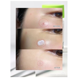 Chấm mụn DR.JART Teatreement Soothing Spot 15ml
