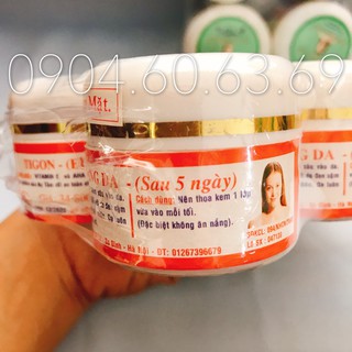 lố 6 hộp kem Tigon
