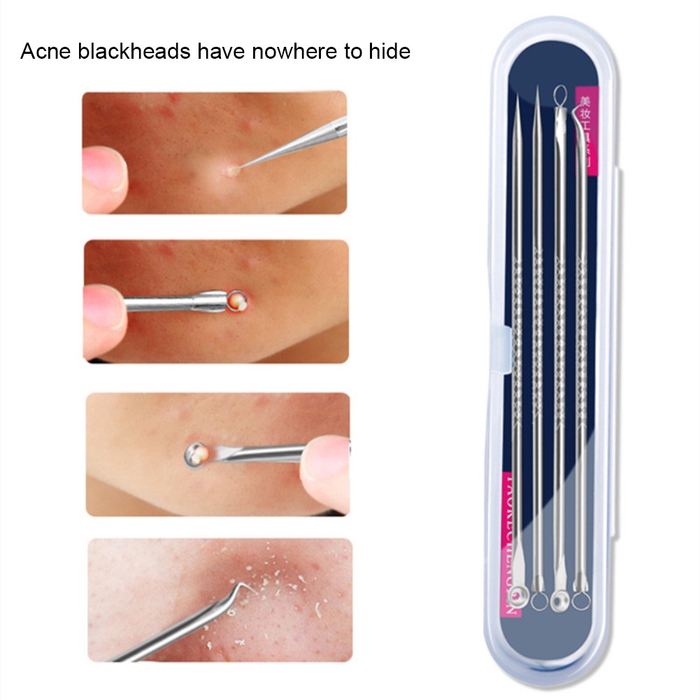 Bộ 4 dụng cụ nặn mụn đầu đen bằng thép không gỉ