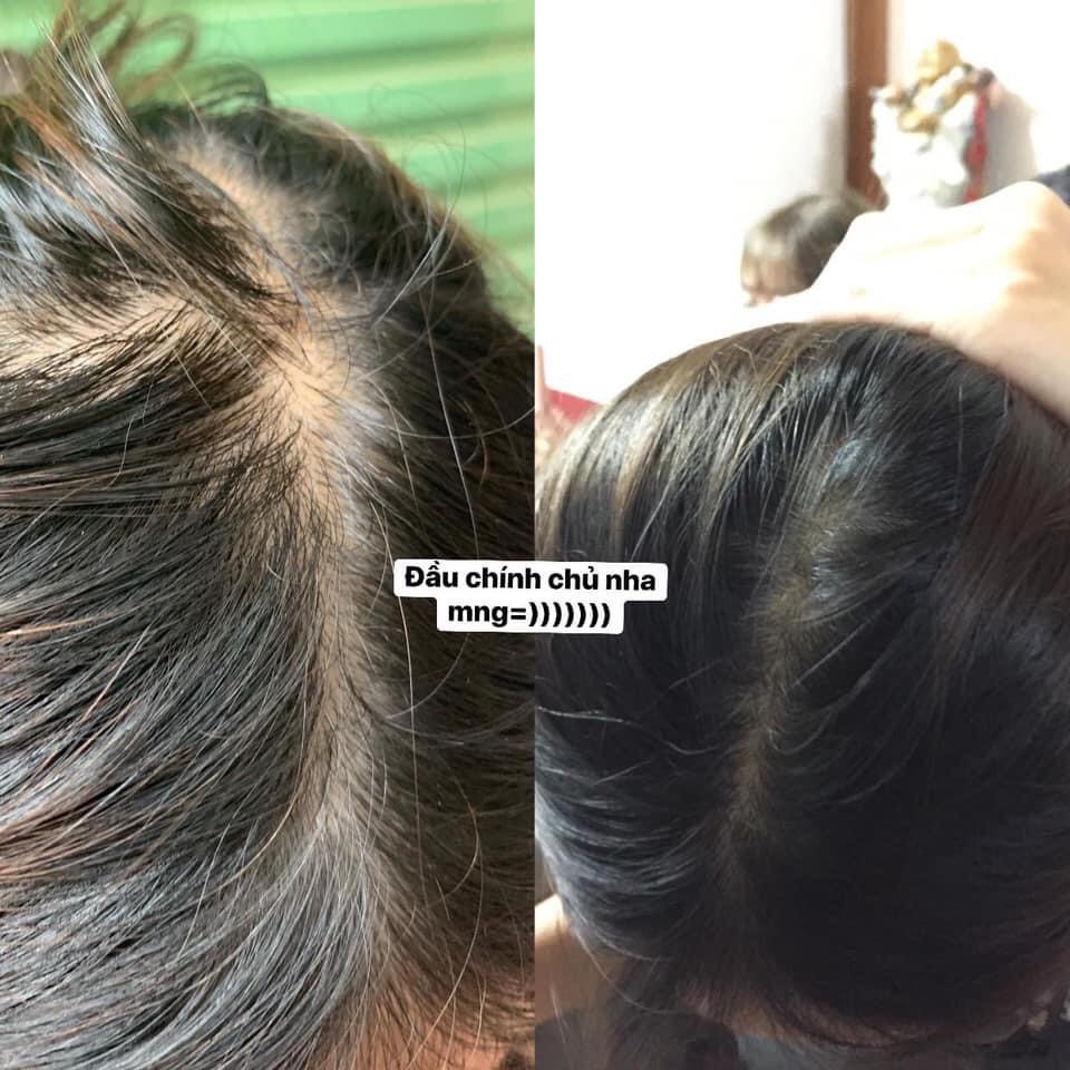 (Tinh dầu bưởi nguyên chất 100%) Giảm rụng tóc, kích thích mọc tóc | BigBuy360 - bigbuy360.vn