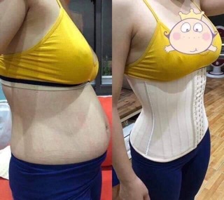 Đai nịt bụng latex 25 xương