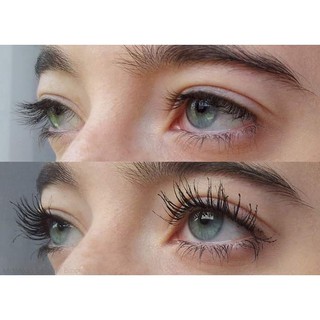 KẸP MI CONG VÚT AOA