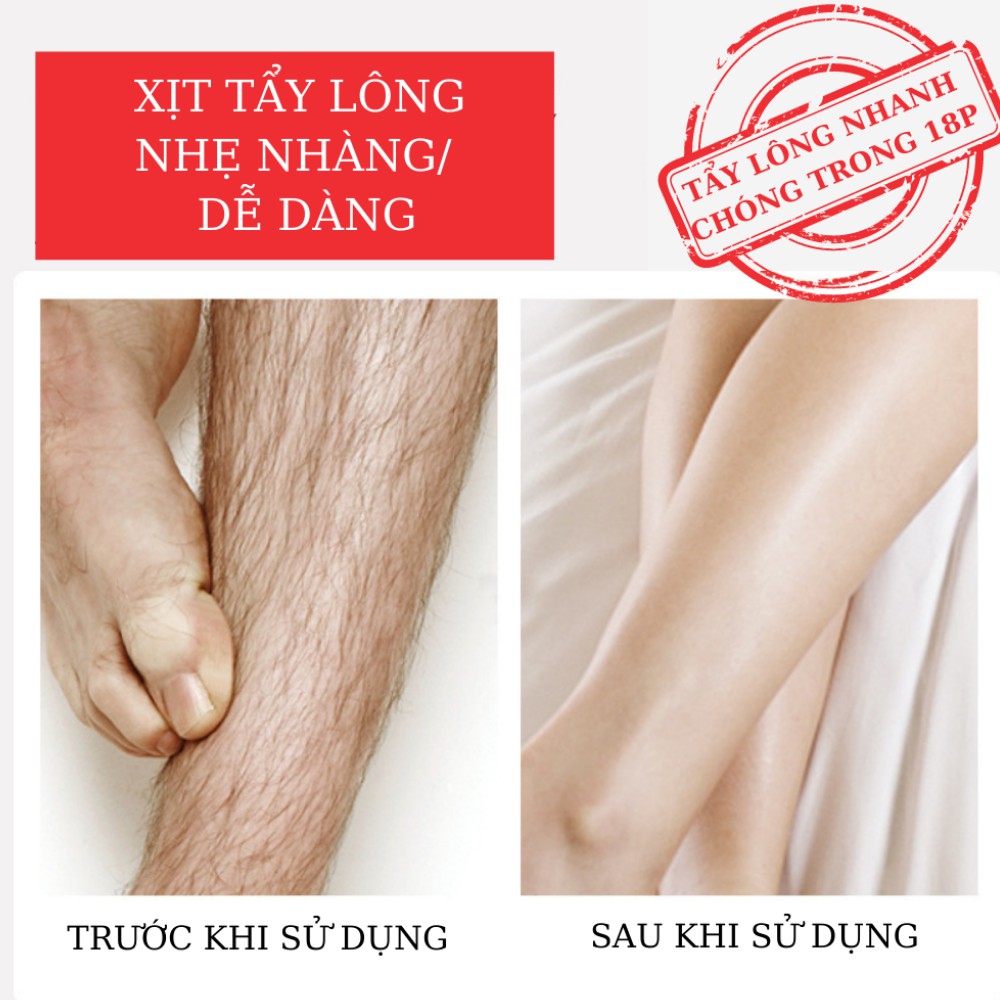 Kem triệt lông, kem tây lông an lành vùng kín ,nách ,chân tay tận gốc ATILA.SHOP