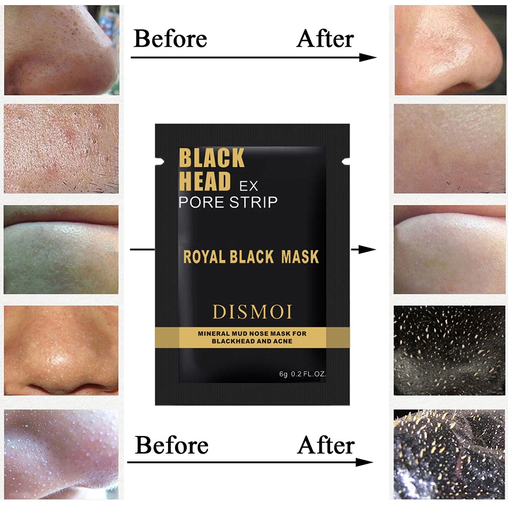 [Hàng mới về] Mặt nạ lột loại bỏ mụn đầu đen vùng mũi làm sạch sâu hiệu quả cao