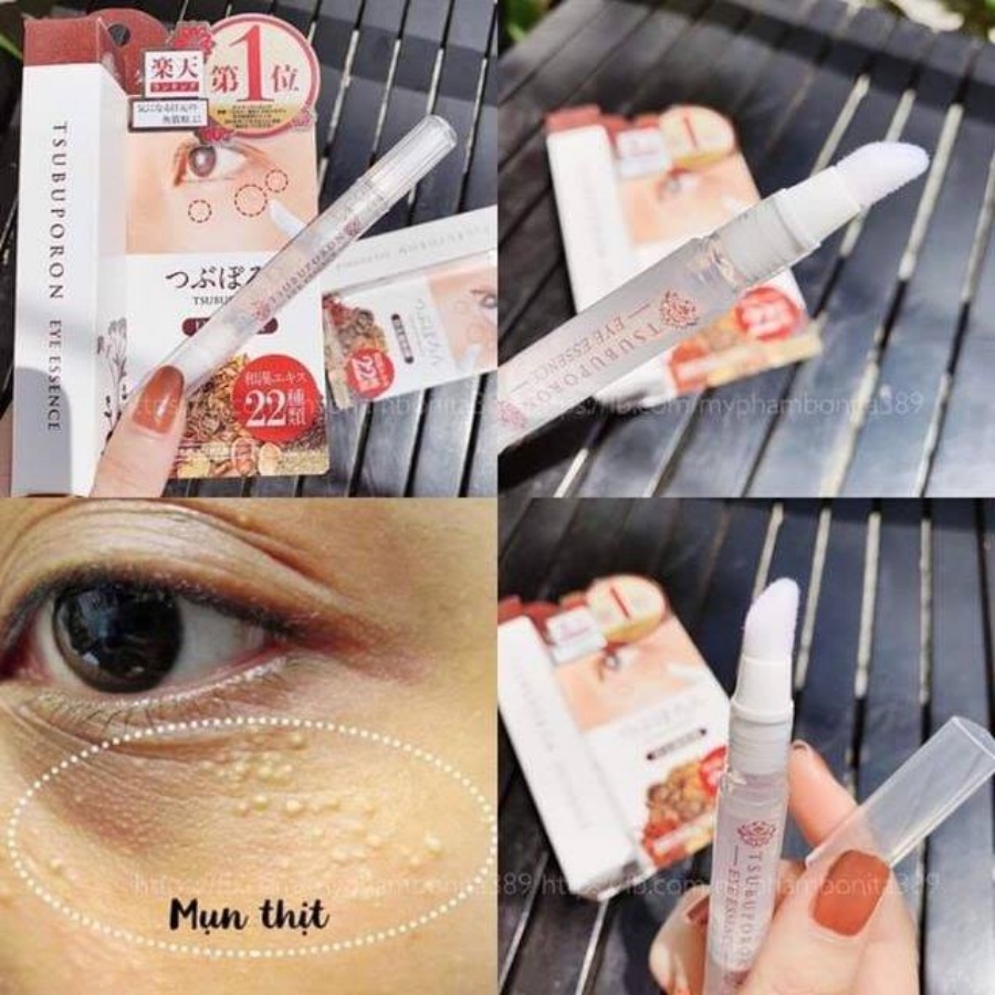 Tinh chất bôi mụn thịt tẩy nốt ruồi Tsubuporon Nhật Bản - Konni39