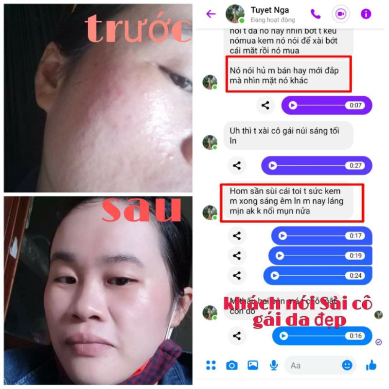 Kem face sữa 5in1 Cô gái Núi - Dưỡng trắng - dưỡng da mỏng yếu