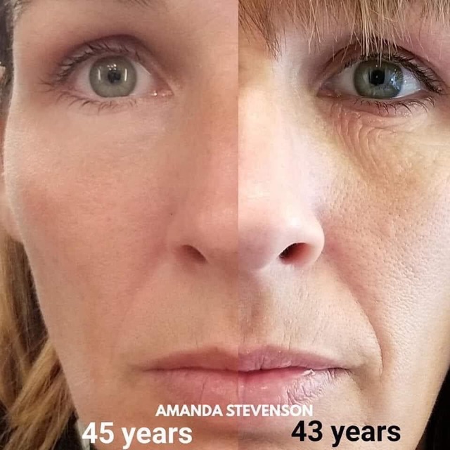 🎀🎀🎀COLLAGEN dạng nước