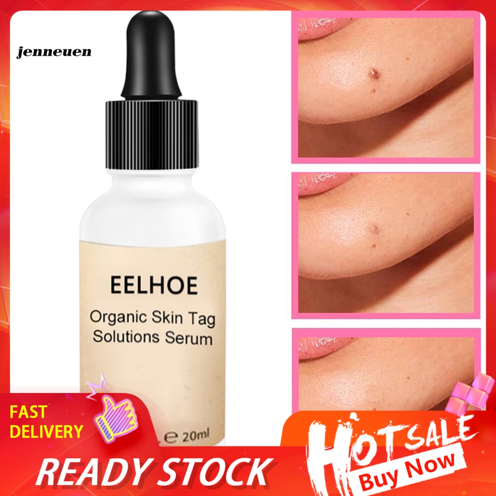 [Hàng mới về] Serum Loại Bỏ Mụn Thịt Dịu Nhẹ Không Gây Kích Ứng Cho Nữ