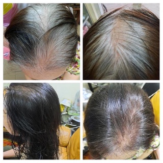 Dầu gội đen tóc thảo dược
