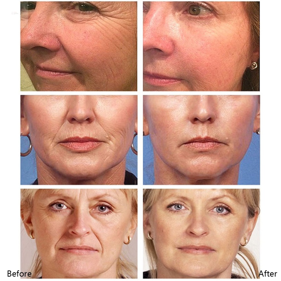 Kem Vitamin C 20% Làm Trắng Xóa Đốm Đen Và Làm Sáng Da Mặt 30ml