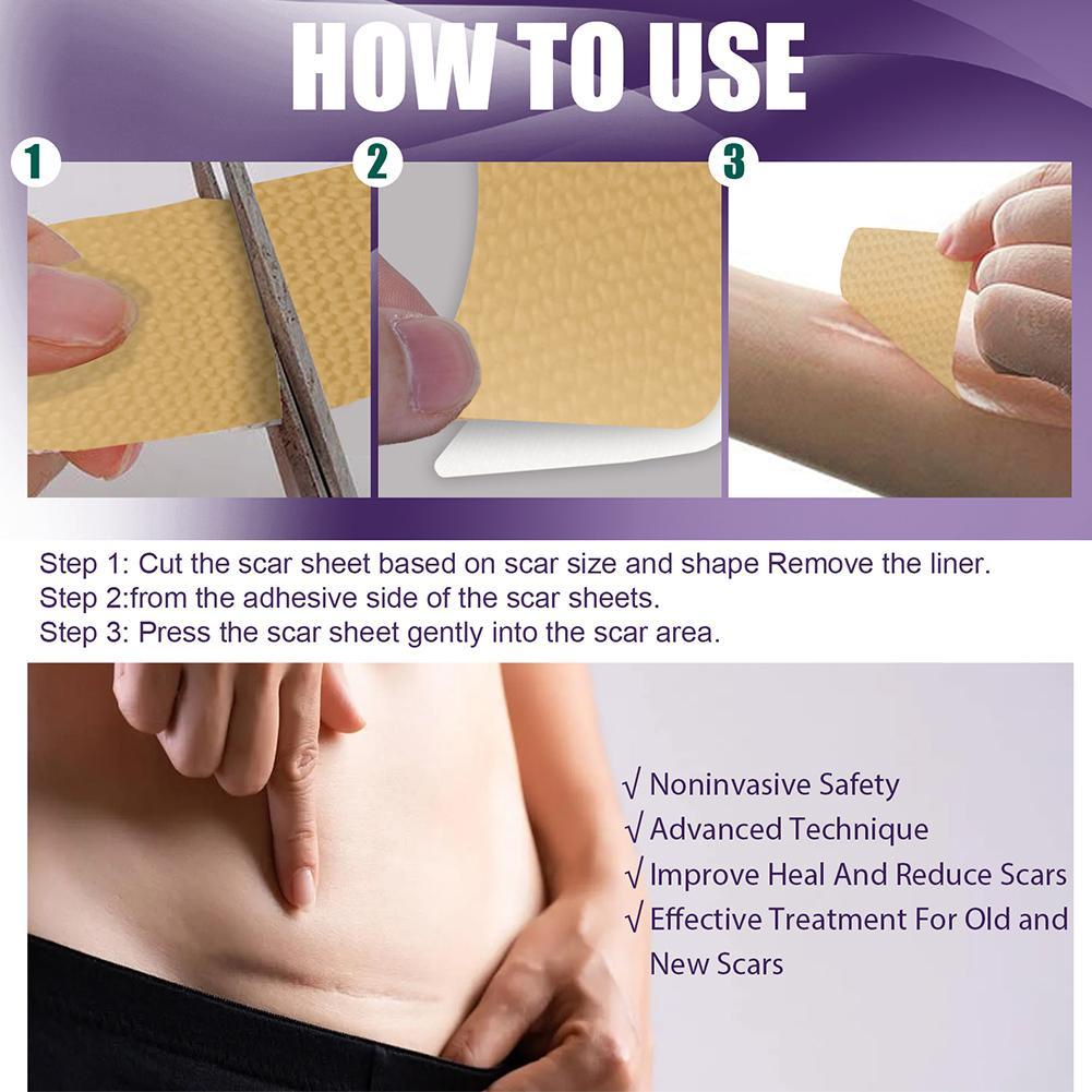 Bộ 8 Miếng Dán Silicone Hỗ trợ giảm sẹo Làm Sáng Tông Màu Da Q2T4