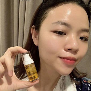 Botox TƯƠI - BE' BALANCE Hàn QUỐC