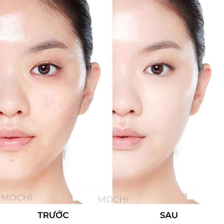 Mặt Nạ Bạc Giảm Mụn l Giảm Sưng Mụn Đỏ l Kiềm Dầu Mask Giấy Sạch Mụn Đầu Đen Pure Skin Bioaqua Nội Địa Trung MOCHI SHOP