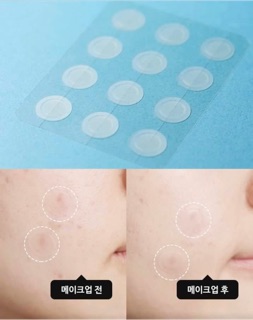 Miếng Dán Mụn Olive Young Care Plus Scar Cover Spot Patch