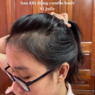 Combo gọi +xịt