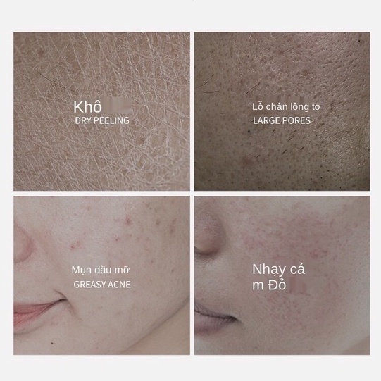 (Hàng Mới Về) 1 Mặt Nạ Chiết Xuất Mật Ong Jomtam Làm Sạch Sâu Dưỡng Ẩm Da 7.5g | BigBuy360 - bigbuy360.vn