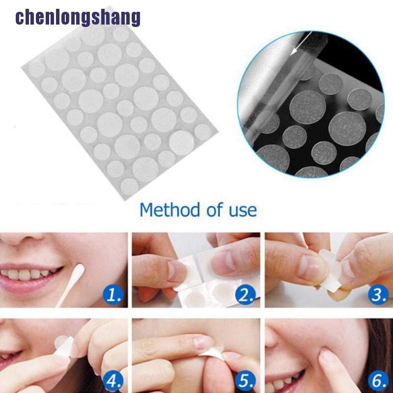 Bộ 36 Miếng Dán Mụn Hydrocolloid Và Mụn Trứng Cá Chăm Sóc Da