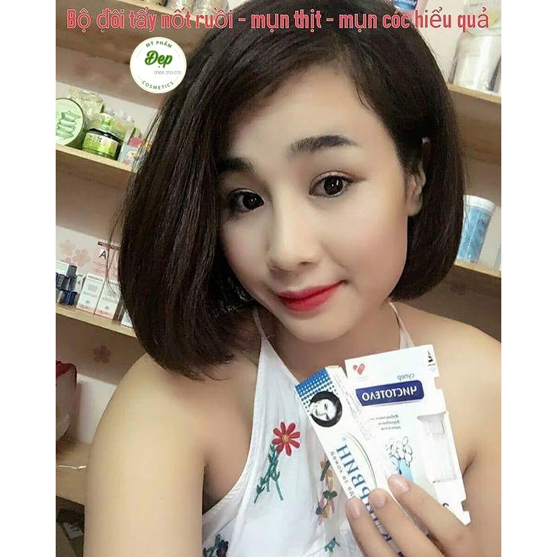 Gel tẩy nốt ruồi, mụn cóc, mụn thịt, tàn nhang, sẹo lồi Develinil