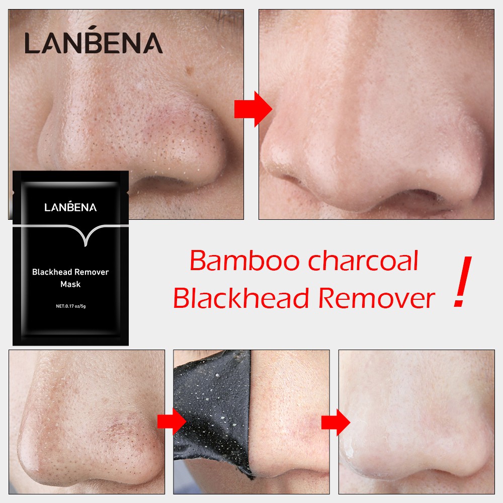 Mặt nạ hỗ trợ lấy mụn đầu đen LANBENA chăm sóc da 5g | BigBuy360 - bigbuy360.vn