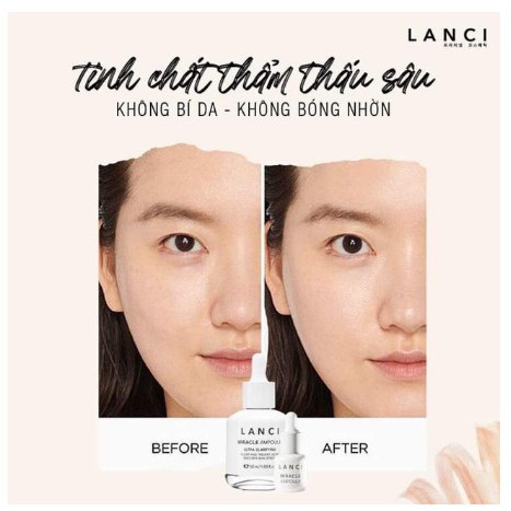 SIÊU SERUM LANCI