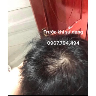 Thuốc mọc tóc Morr F 10%