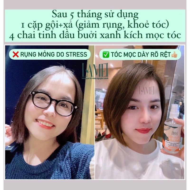 TINH DẦU BƯỞI XANH Lamei 100ml Siêu mọc tóc | BigBuy360 - bigbuy360.vn