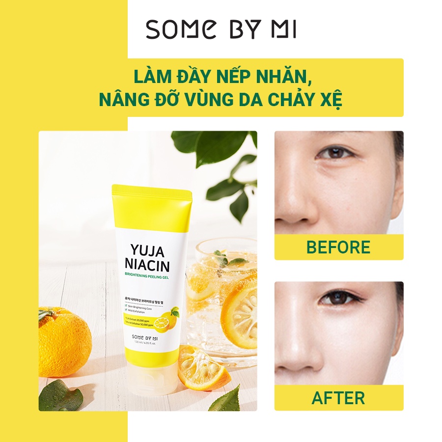 [Mã BMTTC60K giảm đến 60K đơn 50K] Gel Tẩy Da Chết, Dưỡng Trắng Da Some By Mi Yuja Niacin Brightening Peeling Gel 120ml