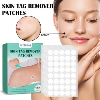 120 miếng dán trị mụn cóc trị mụn cóc nốt ruồi Bri
