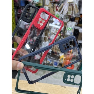 Ốp lưng Xiaomi Redmi Note 11S / Note 11 4G