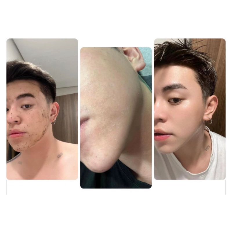 Peed da Vi Tảo Retinol 7 ngày sáng mịn.