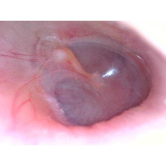 Camera nội soi tai mũi họng đầu dò 4.5mm HD