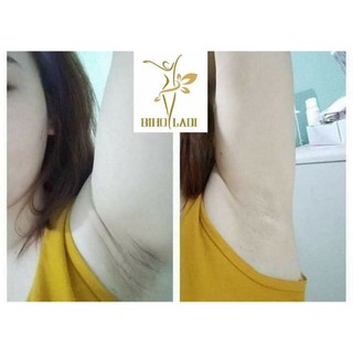 SIÊU DƯỠNG THÂM  BIHO LADI 5S