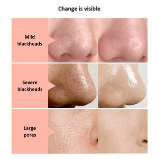 Tuan067 saniye gel lột mụn đầu đen black mask làm sạch sâu bh001 tuan067