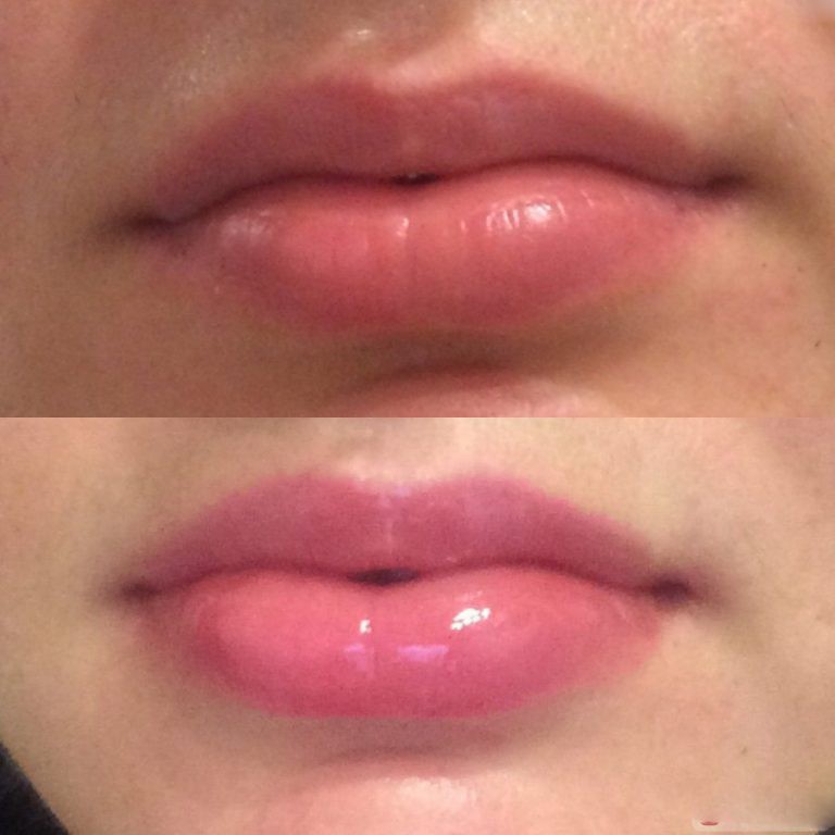 Serum định hình môi trái tim hiệu ứng botox không tiêm EVELINE HYALURON LIP PUSH-UP