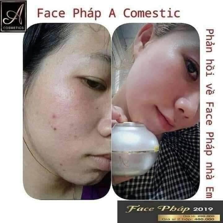 Kem Face Pháp 2019 - Dưỡng Trắng Da Mặt