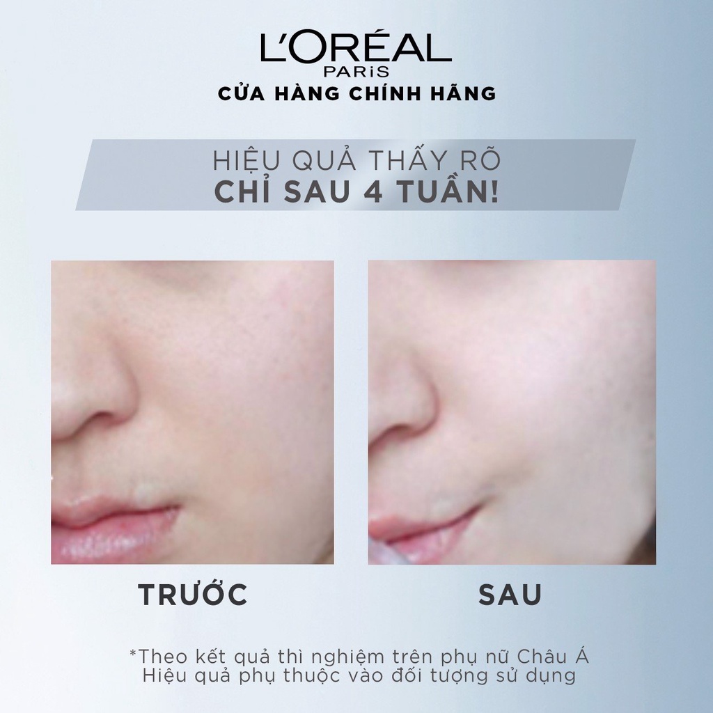 Tinh Chất Tăng Cường Dưỡng Da Trắng Mịn & Giảm Thâm Nám L'oreal Paris White Perfect Clinical - 30ml
