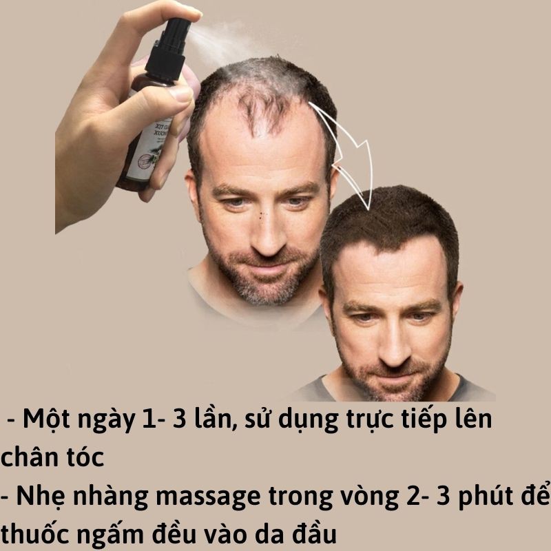 Thuốc mọc tóc Đông y gia truyền Thông Cát hiệu quả đến bất ngờ | BigBuy360 - bigbuy360.vn