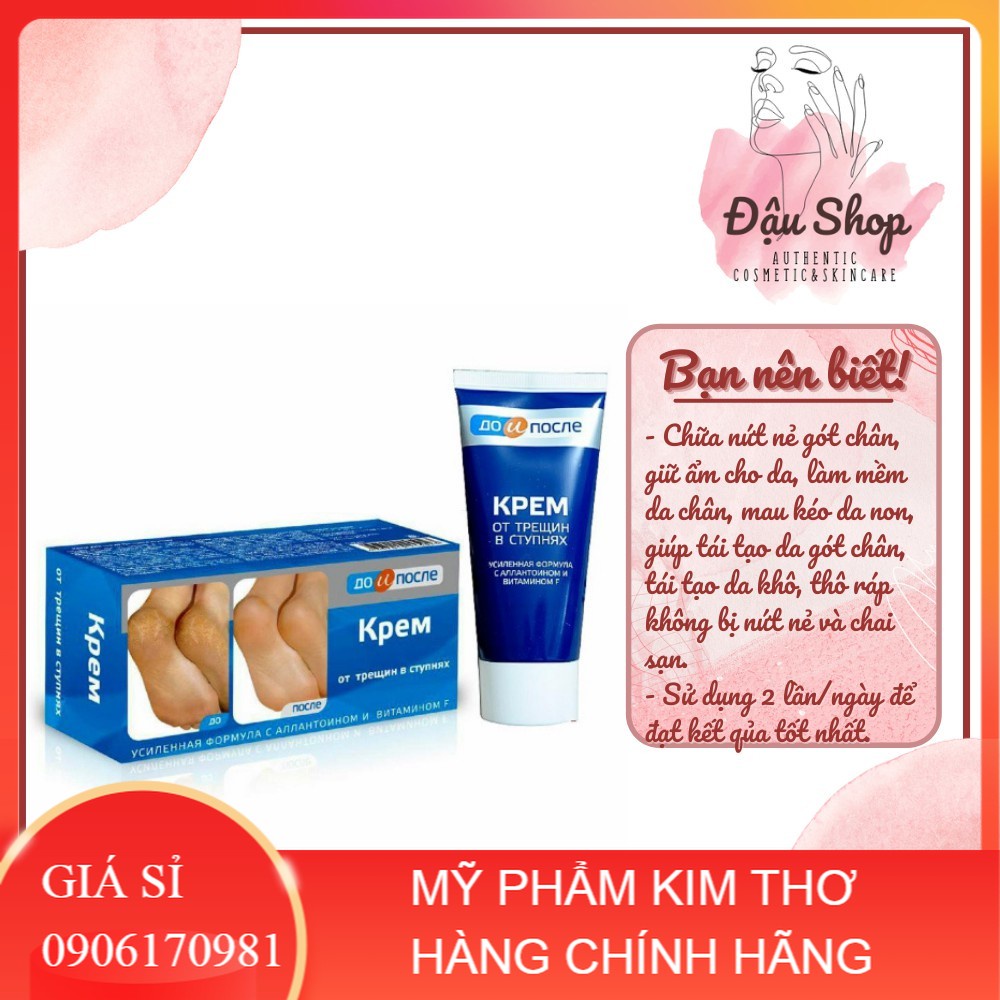 Kem giảm nứt gót chân Kpem Apteka của Nga 50ml