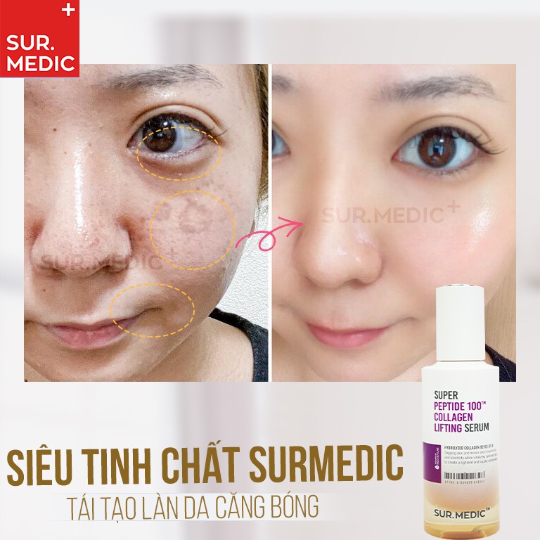 Tinh Chất Trẻ Hoá Da SURMEDIC Super Peptide 100tm Collagen Lifting Serum 50ml | BigBuy360 - bigbuy360.vn