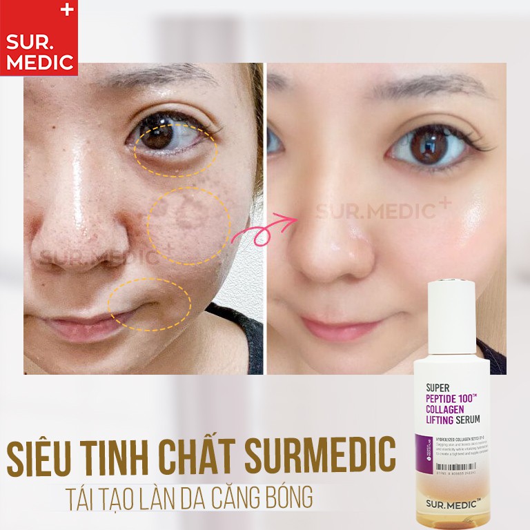 Tinh Chất Trẻ Hoá Da Sur.medic+ Super Peptide 100tm Collagen Lifting Serum 50ml