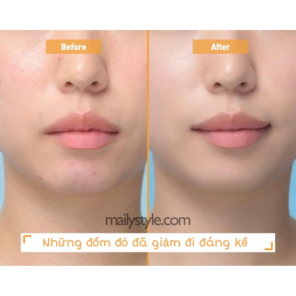 Toner Hoa Cúc Veridique - Veridique Cica Calendula Water 250ml | BigBuy360 - bigbuy360.vn