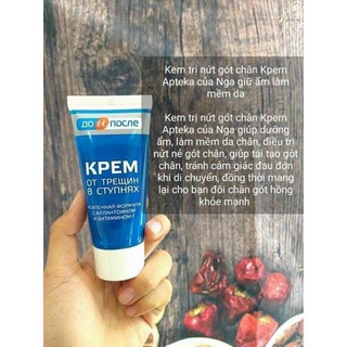 Kem Nứt Nẻ Gót Chân KPEM Nga