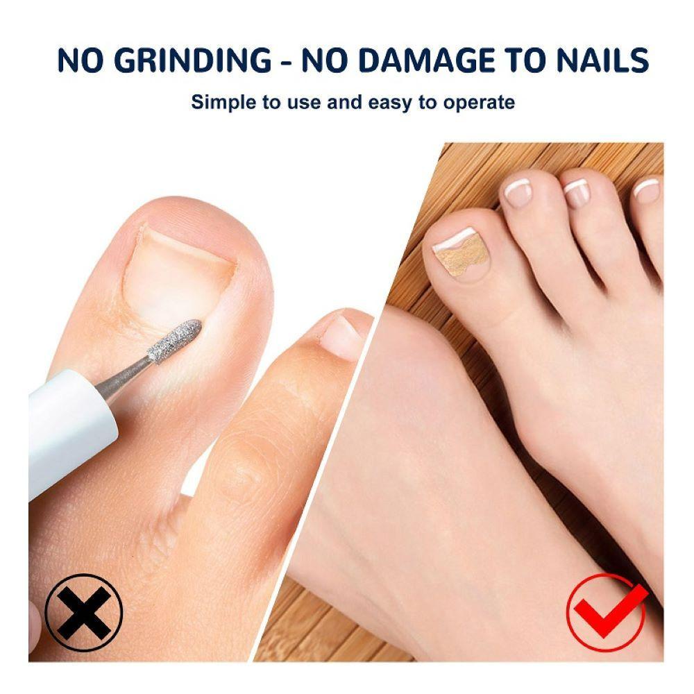 LAY Bộ 50 Miếng Dán Chỉnh Sửa Móng Tay